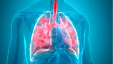 Is Pneumonia Contagious? Key Facts About How It Spreads