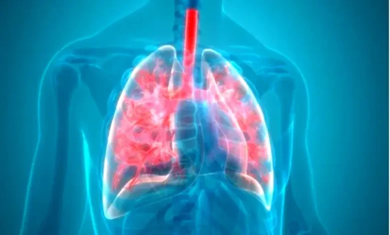 Is Pneumonia Contagious? Key Facts About How It Spreads